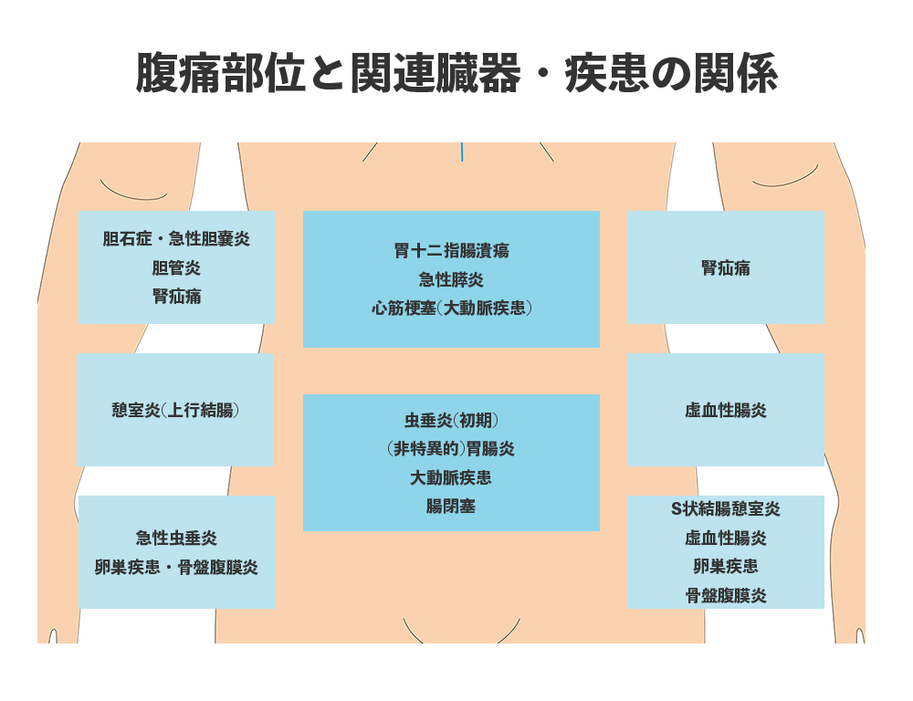 急性腹症